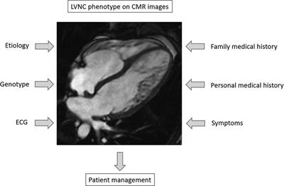 Genetic, clinical and imaging implications of a noncompaction phenotype population with preserved ejection fraction